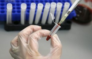 Заболеваемость гепатитом A в Самарской области выросла на 75%