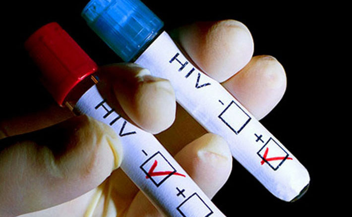 12 новых случаев ВИЧ