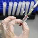 Заболеваемость гепатитом A в Самарской области выросла на 75%