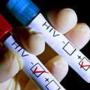 12 новых случаев ВИЧ