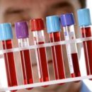 Самарские учёные разработали способ диагностировать рак за 5 минут